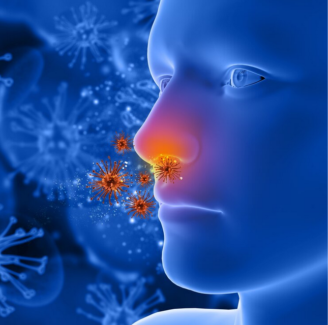 اسباب التهاب الجيوب الأنفية